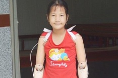 Limbless girl receives artificial arms and legs