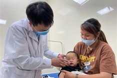 Charity provides free cleft lip operations for disadvantaged people