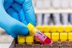 Vietnam reports three more Covid-19 infection cases on Saturday
