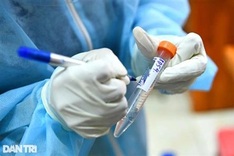 New Covid-19 infections confirmed in more localities