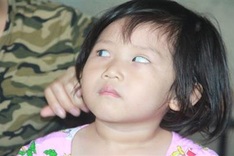 Two little poor siblings get free eye treatment