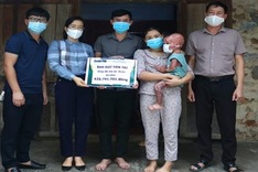 Readers help little boy with severe burns