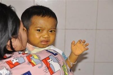 Little boy struggling with biliary atresia needs help