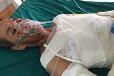 Family in critical condition after fire accident