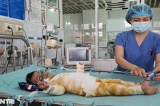 Dantri/DTiNews readers support seriously-burnt boy in Bac Giang