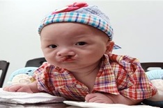 Abandoned baby with cleft palate sent to social protection centre