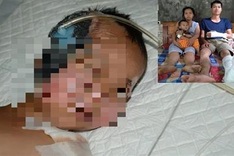 5-year-old boy suffers severe injuries after truck accident