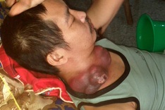 Poor man on verge of death in dire need of help