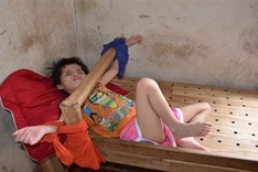 Cerebral palsy twins in need of help