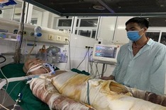 Widow with serious burns in dire need of support