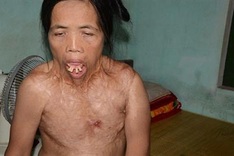 Free treatment to be offered for woman with deformed face