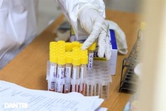 Vietnam confirms 50 more Covid-19 infections in Friday noon report