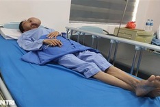 Woman with distorted face seeks help