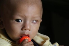 Little boy at risk of going blind from cancer