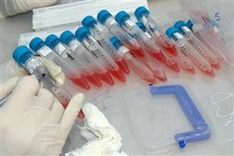 Hotel staff tests positive for SARS-CoV-2 in Yen Bai Province