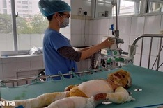 Little girl facing serious burns in dire need of help