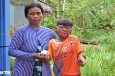 Seriously-burnt boy in desperate need of support