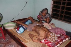 Man struggling with osteoma needs help