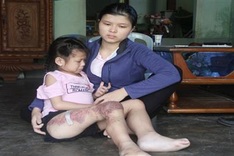 Little girl struggles to survive against cancer