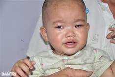 Poor ethnic minority couple call for help to save daughter from retinoblastoma