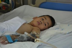 Six-year-old boy could lose limb after traffic accident
