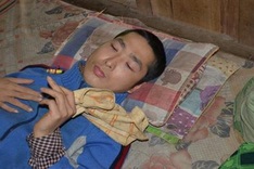 Tay ethnic man calls for help to treat tuberculosis