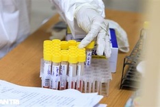 Two more Covid-19 deaths reported in Vietnam