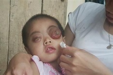 Plea to save little girl from brain cancer blindness