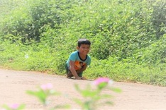 Little boy with deformed legs in need of support