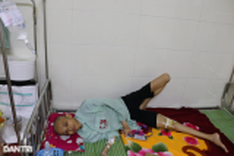 Young woman struggling with bone cancer in dire need of help