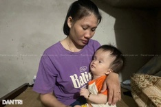 Little girl suffering from hydrocephalus needs help