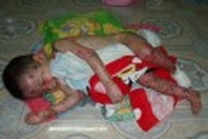 Family struggles to cope with child’s disease