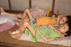 Readers help two sick boys in Ha Tinh Province