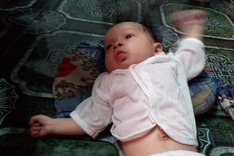 Baby suffers chronic pneumonia and heart disease