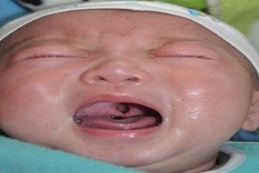 Five-month old boy born with deformities in need of help