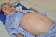 Boy facing fourth brain operation seeks help