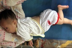 Malnourished baby fighting heart disease to survive