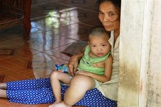 Three-year-old suffers from swollen limbs