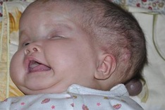 Mother helpless as both children struggle with illnesses