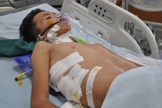 12-year-old boy lost a part of his lung to illness
