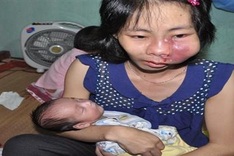 Mother on verge of death begs help for her children