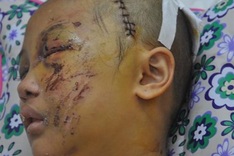 11 year-old girl injured after tragic accident