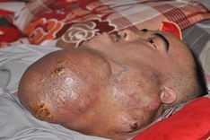 Poor man with lethal tumour seeks help to send his kids to school