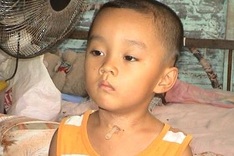 Young boy awaits fourth larynx surgery