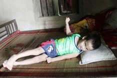 Little boy struggles with cerebral palsy