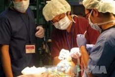 Japanese doctors offer free surgery to children with cleft lips, palates