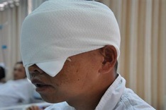Man loses eyesight in bear attack