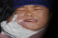 Farther, son in losing battle against cancer