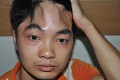 Disabled man takes care of brother suffering from Haemophilia