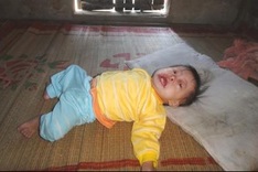 13-month-old baby plagued by serious diseases